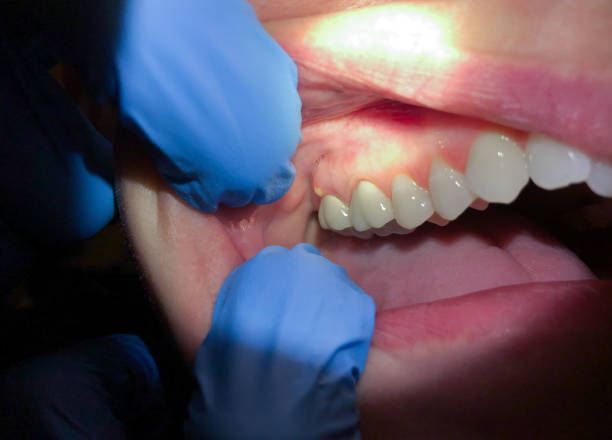 Best Emergency Gum Pain Relief  in Barron, WI