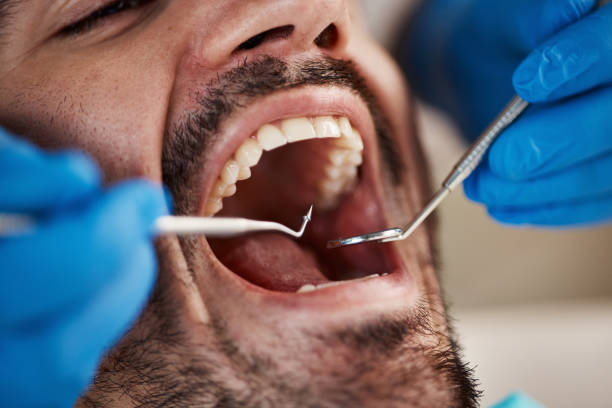 Best Chipped Tooth Repair Near Me  in Barron, WI